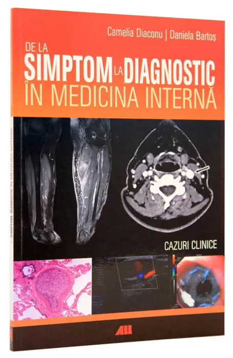 DE LA SIMPTOM LA DIAGNOSTIC IN MEDICINA INTERNA